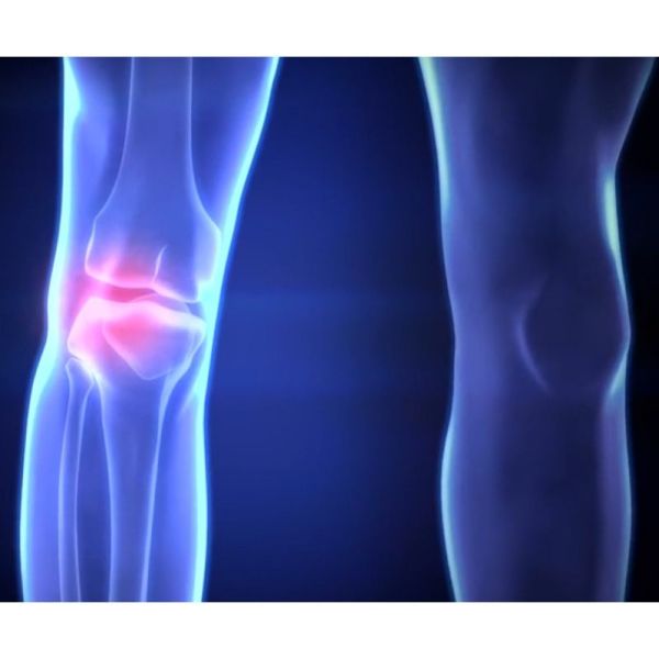 Attelle de genou Reaction - Bleue pour soulager douleur rotulienne